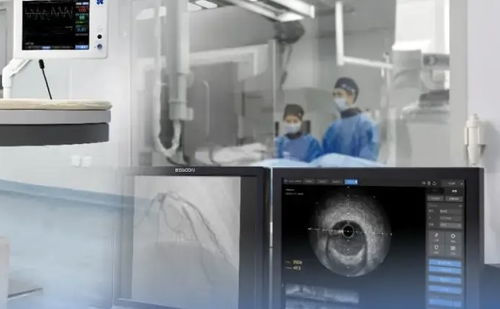 上半年45個創(chuàng)新醫(yī)療器械獲批，國產超聲設備向高端化邁進